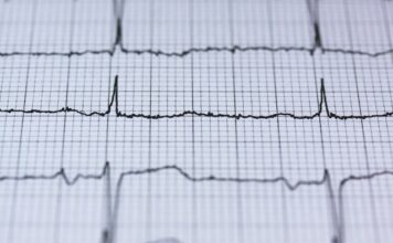 Badanie EKG – jak wygląda i na czym polega? EKG